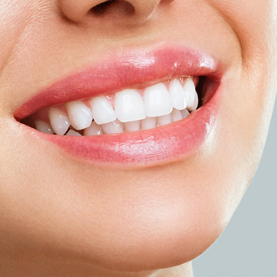 Transformations complètes du sourire